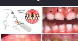 My mouth tastes like teeth "My mouth tastes like teeth" - a strange and unsettling statement that immediately evokes a