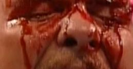 Stone Cold Steve Austin passionately reacts with a fierce expression, blood streaming down his face during an intense match.