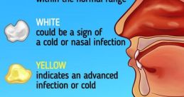 Snot Theuishy of snot being blown out of a nose is one that is all too familiar to most of us. It's a that can often be