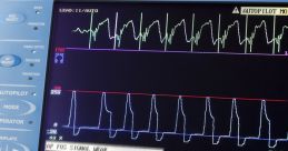 Telemetry Telemetry clips and effects to play and download.