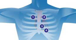 Cardiac play a crucial role in identifying and understanding Cardiac S anatomy. The rhythmic thumping of the heartbeat is a