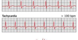 110-Bpm From the pulsating thump of the 110 Bpm Fm Rhythm -01 loop to the hypnotic beat of the Synth Loop Polaris at 110