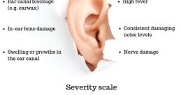 Hearing defect Library When it comes to hearing defects, one of the most common symptoms is tinnitus. Tinnitus is a ringing,