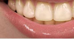 Teeth When it comes to the subject of teeth, there are a variety of that can be associated with them. One such is that