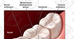 Mesial from mesial. # #theme #sad #background #violin #effects #symphonicband #classical #track #drum #drumkit #snaredrum