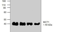 MCT1 The first related to MCT1 is a sharp, rhythmic beep. This serves as a signal to indicate a successful connection