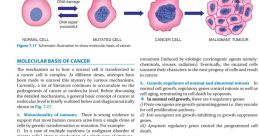 Mohen cancer The of "Mohen cancer" reverberates like a haunting melody, echoing through the minds of those impacted by this