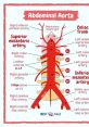 Diagram of the abdominal aorta showing major branches and arteries, highlighting key vascular structures for anatomy studies.