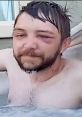 Man with a bruised eye relaxing in a hot tub, showcasing the quirky and unpredictable side of Loulz IP2 culture.