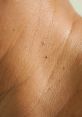 Skin tab The surface of an acrochordon may be smooth or irregular in appearance. It is often raised from the surface of the