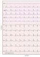 ECG ECG - ECG or Electrocardiography and effect requested by sumith. The first that comes to mind when thinking about