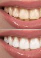 Teeth When it comes to the subject of teeth, there are a variety of that can be associated with them. One such is that