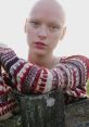 Bald model Joelle Rasmussen poses thoughtfully in a cozy, patterned sweater against a bright, natural backdrop.