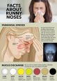 Exploring runny noses, paranasal sinuses, and mucus discharge color indicators for better health understanding.