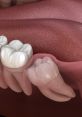 Detailed anatomy of wisdom teeth, showcasing their position and structure within the mouth and gums.